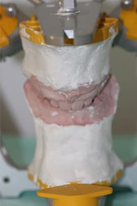 Estudio protésico en Clínica Dental Pablo Moreira